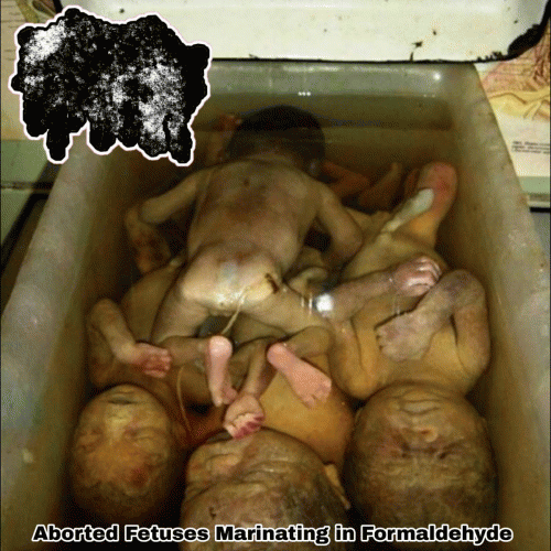 Aborted Fetuses Marinating in Formaldehyde